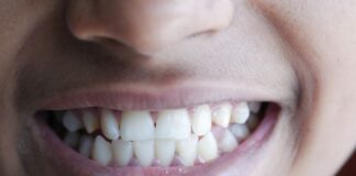 Naturalny efekt w stomatologii estetycznej – od diagnostyki po indywidualny plan poprawy uśmiechu zęby